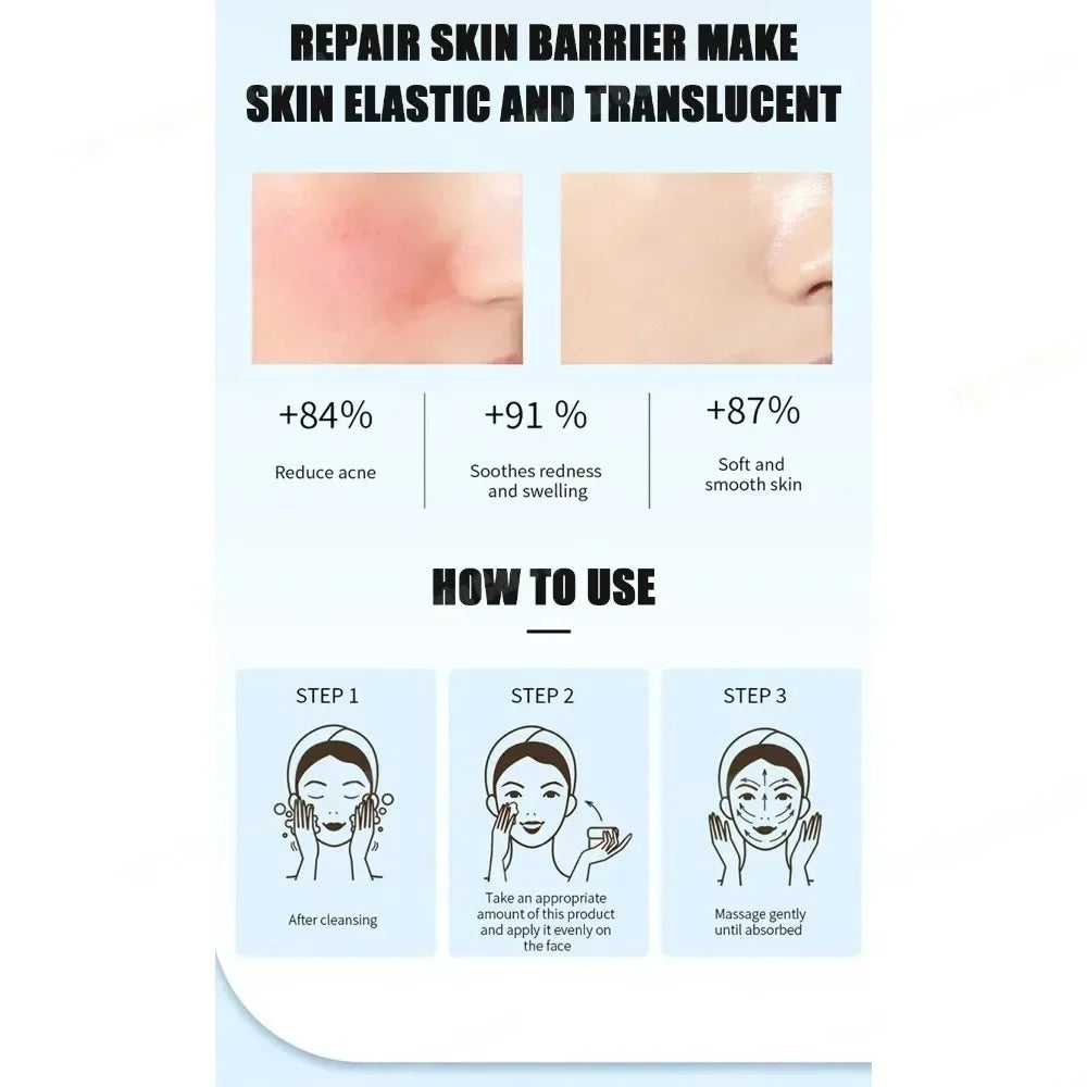 Face Serum Acne Treatment