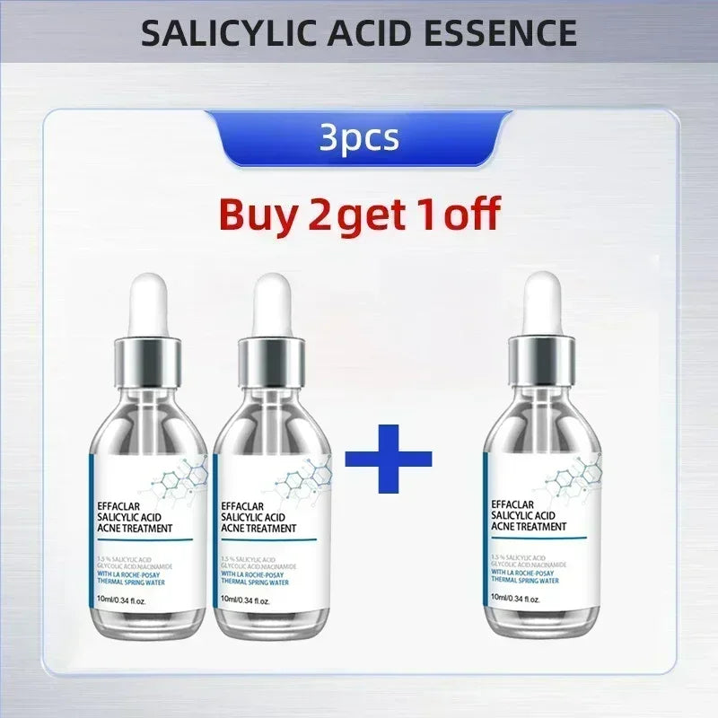 Face Serum Acne Treatment