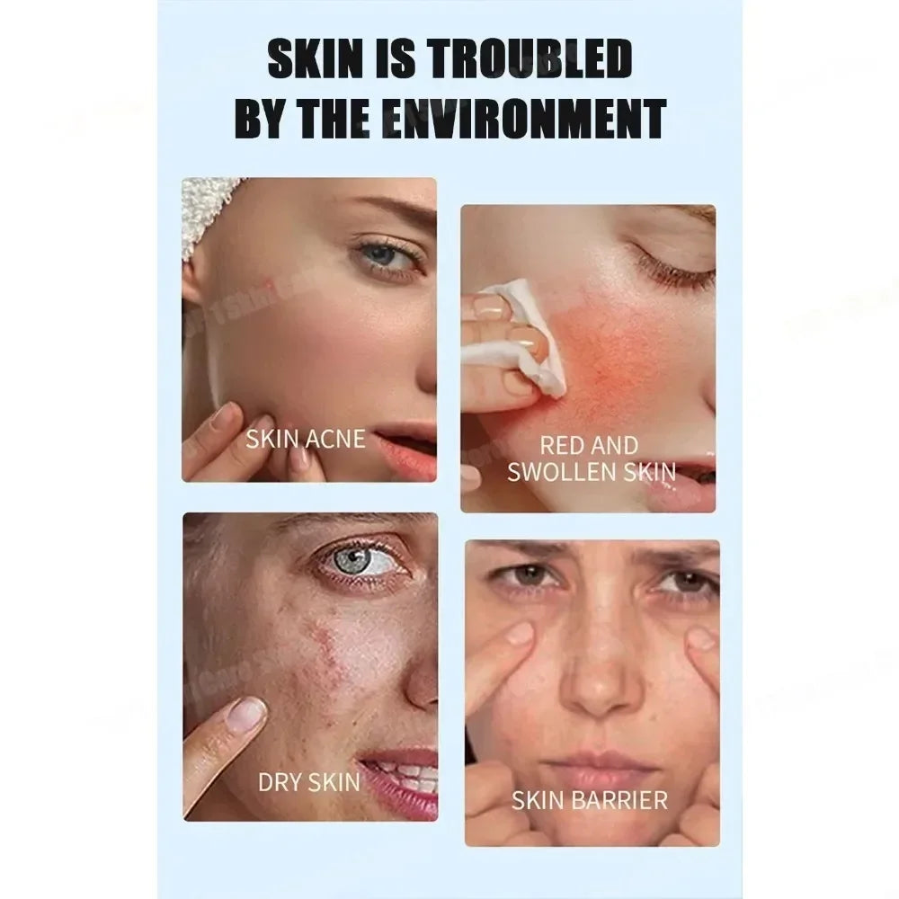 Face Serum Acne Treatment